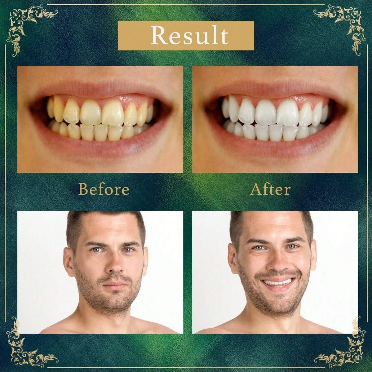 Cepillo de dientes natural Miswak